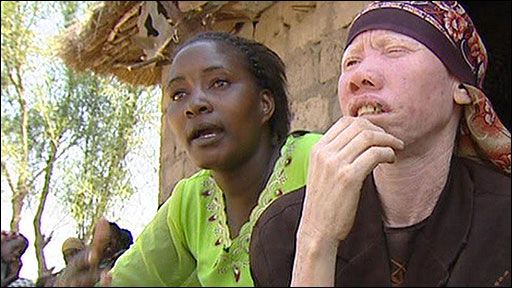 Tanzania bans witch doctors to halt albino murders